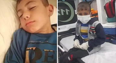 Başıboş Köpeklerin Saldırdığı 2 Çocuk Kuduza Yakalandı