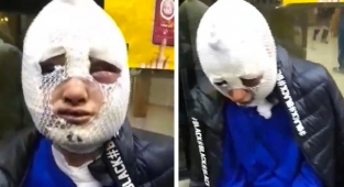 Evini Bastığı Kadına Cinsel Saldırıda Bulunup Üstüne Kızgın Yağ Döktü