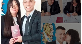 Yüzüne Kezzap Atan Sevgilisi İle Evlendi