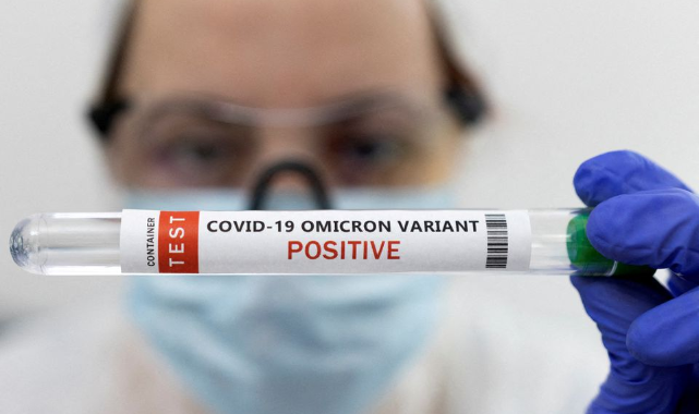 Araştırmaya Göre Omicron İnsan Derisinde 21 Saat Hayatta Kalıyor
