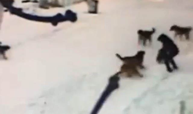 Kars'ta Bir Çocuk Başıboş Köpeklerin Saldırısına Uğradı: Geri Püskürttü