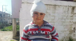Bir Pitbull, 6 Yaşındaki Çocuğu Yaraladı