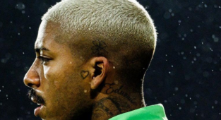 Giresunspor'un Yeni Transferi Pyerre'in Testislerinde Tümör Bulundu