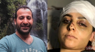 Kadına Şiddet: Tayt Giydiği Bahanesiyle Eşini Öldüresiye Dövdü