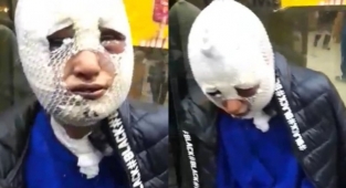 Eski Sözlüsünün Başına Kızgın Yağ Döken Zanlı Tahliye Edildi