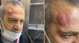 Şanlıurfa'da Şehir Eşkıyaları Hemşireyi Darp Etti