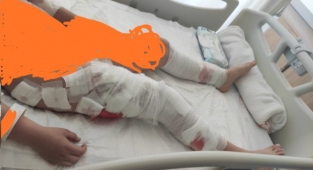 Başıboş 8 Sokak Köpeği Okula Giden 10 Yaşındaki Çocuğu Parçaladı
