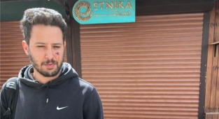 Başıboş Köpek Kendisini Sevmek İsteyen Oyuncuya Saldırdı: Gözünden Oluyordu