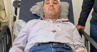 'Beni Taciz Ediyorsun' Diyerek Doktorun Burnunu Kırdı