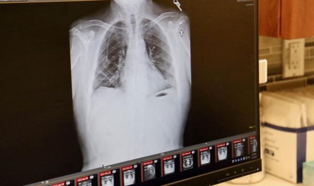 Bir Genç Mastürbasyon Yaparken Ciğerini Yırttı