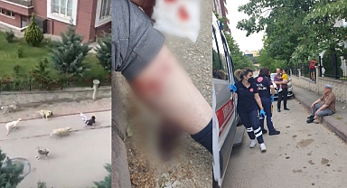 Ankara Yenimahalle'de Bir Saat Arayla İki Başıboş Köpek Saldırısı: İki Yaralı
