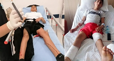 Başkent Ankara'da Başıboş Köpek Saldırısı: Öğrenciyi Öğretmenleri Kurtardı