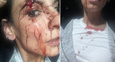 Evinin Önünde Bira İçen Kadınlar 5 Erkeğin Saldırısına Uğradı: Yaralılardan Birinin Durumu Ağır