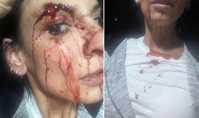 Evinin Önünde Bira İçen Kadınlar 5 Erkeğin Saldırısına Uğradı: Yaralılardan Birinin Durumu Ağır