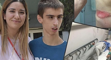 Hastanede 10 Saat Yatağa Bağlı Kalan Otizmli Genç Ellerini Kullanamıyor