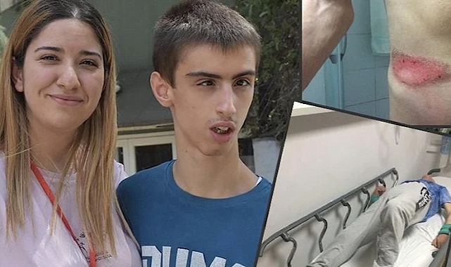 Hastanede 10 Saat Yatağa Bağlı Kalan Otizmli Genç Ellerini Kullanamıyor