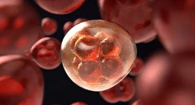 Polonya'da İlk Maymun Çiçeği Vakası Görüldü