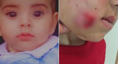 2 Yaşındaki Ali Asaf'ı Öldüren Köpek Kuduz Çıktı: Ali Asaf Balkondayken Saldırıya Uğramış