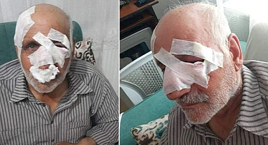 Köpek Saldırısına Uğrayan 72 Yaşındaki Adam 54 Günlük Yaşam Savaşını Kaybetti