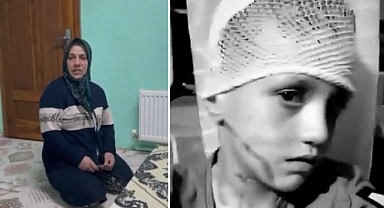 Suriyelilerin Yüzüne Kezzap Attığı Çocuğun Annesi Yandaş Basına İsyan Etti