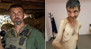 İşgalci Rusya, Savaş Esirlerine İşkence Yapıyor