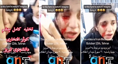 Fars Polisi Güney Azerbaycanlı Öğrencinin Gözünü Çıkardı