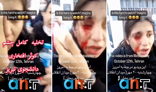 Fars Polisi Güney Azerbaycanlı Öğrencinin Gözünü Çıkardı