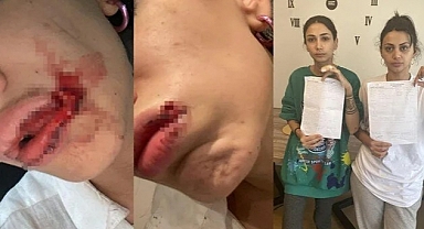 İki Kız Kardeş, Kendilerini Taciz Eden Şahsın Saldırısına Uğradı