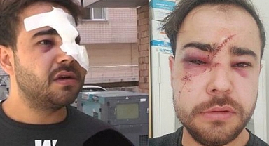 İstek Parçayı Çalmayan Sokak Müzisyeninin Yüzünü Cam Şişeyle Parçaladılar