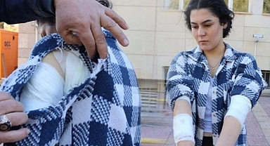 Nevşehir'de Okula Giden Üniversite Öğrencisine Başıboş Köpek Saldırdı