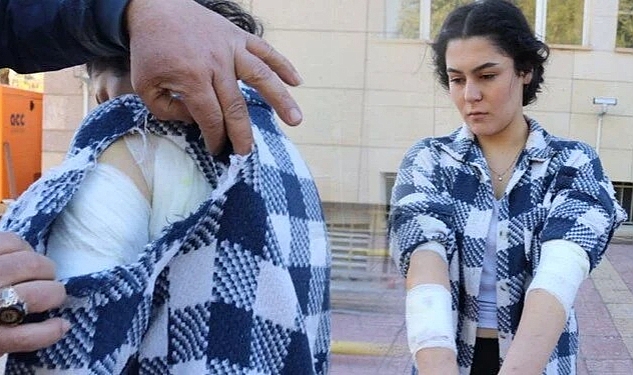 Nevşehir'de Okula Giden Üniversite Öğrencisine Başıboş Köpek Saldırdı
