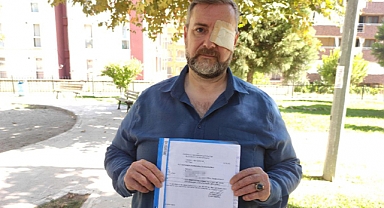 Tarihi Geçmiş Döner Satmayı Reddeden Şef Darp Edildi