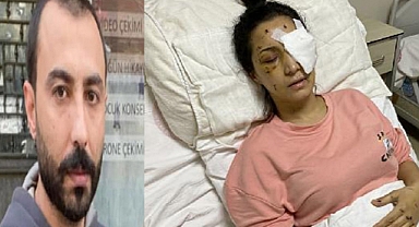 Yengesini 37 Yerinden Bıçaklayıp Gözünü Kör Etti: 15 Yıl Hapis Cezası Aldı
