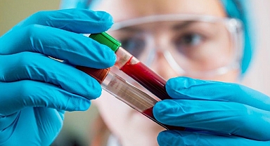 Ferritin Ne İşe Yarar, Hangi Besinlerde Bulunur?