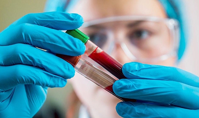 Ferritin Ne İşe Yarar, Hangi Besinlerde Bulunur?