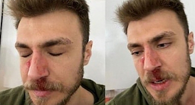 Şehir Eşkıyası, 'Erkek Doktor İstemiyorum' Diyerek Doktora Saldırdı: Mürteci Yeni Akit Sahip Çıktı
