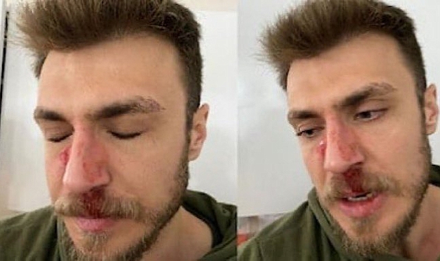 Şehir Eşkıyası, 'Erkek Doktor İstemiyorum' Diyerek Doktora Saldırdı: Mürteci Yeni Akit Sahip Çıktı