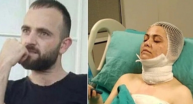 Bir Yıl Önce Boşandığı Kadının Yüzüne Kimyasal Madde Attı
