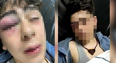 Diyarbakır'daki Nevruz Olaylarında 14 Yaşındaki Çocuğu Darp Eden 5 Polis Gözaltına Alındı