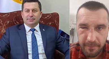 AKP'li Belediye Başkanının Yakınlarından Kahveci Dükkanı İşleten Kişiye Sopalı ve Silahlı Saldırı İddiası