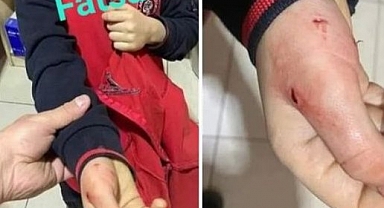 Ordu'da İlkokul Bahçesinde Oyun Oynayan 9 Yaşındaki Çocuk Başıboş Köpek Saldırısına Uğradı