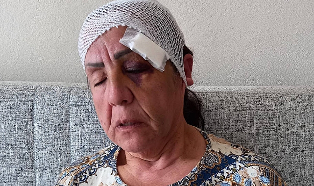 AKP Uşak Milletvekili Adayının Babası Bir Kadını Keserle Darp Etti İddiası
