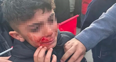 Devlet Bahçeli Çocuk Taşlamayı Sorumlu ve Şuurlu Buldu