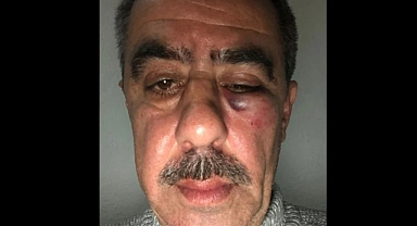 Konya'da AKP İlçe Başkanı ve AKP'li İlçe Belediye Başkanı, İYİ Partili Müşahidi Hastanelik Etti