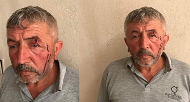 Ordu'da Belediye İşçisi Genel Sekreter Yardımcısı Tarafından Darp Edildi İddiası