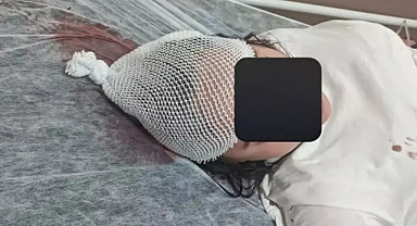 YTÜ Davutpaşa Kampüsünde Yine Başıboş Köpek Vakası: Öğrenci Ağır Yaralandı 