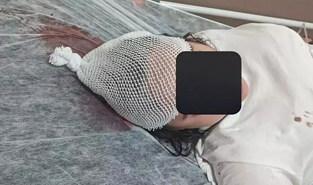 YTÜ Davutpaşa Kampüsünde Yine Başıboş Köpek Vakası: Öğrenci Ağır Yaralandı