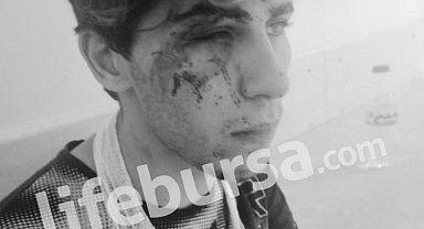 Bursa Valiliği'nden Suriyeli Sığıntıların Saldırdığı Türk Genci Hakkında Yeni Açıklama