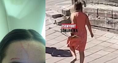 İktidar Medyasının 'Başörtülü Kadınlara Saldırdı' Diye Servis Ettiği Görüntülerdeki Kadın Akli Dengesi Bozuk Bir Yabancı Uyruklu Çıktı