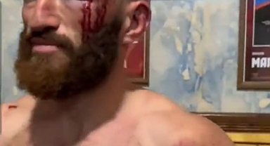 Rus Ordusunda Görev Yapan Bir Asker Çerkes Olduğu İçin Öldüresiye Dövüldü